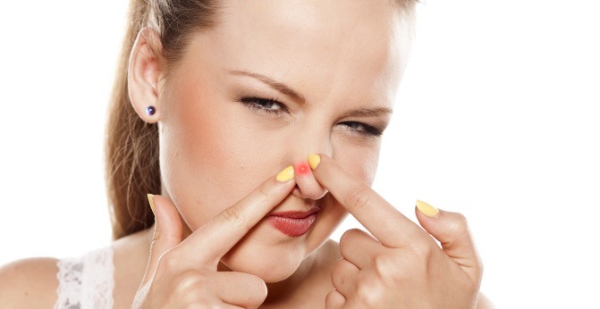 Acne Prevention